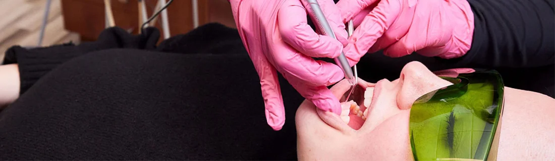 Canker Sore Treatment in Chicago IL Canker Sore Treatment in Chicago IL