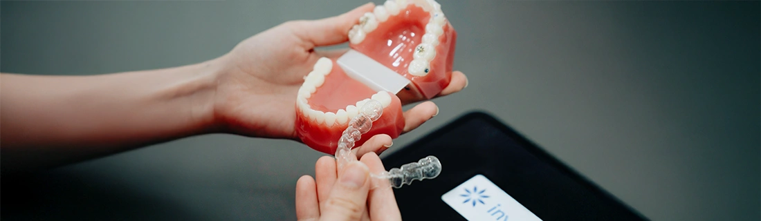 Invisalign in Chicago IL – FC Invisalign in Chicago IL – FC