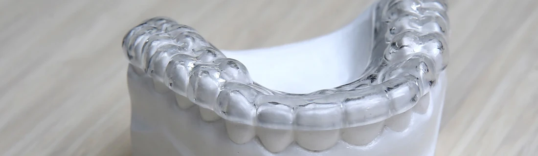 Dentist Chicago IL Mouthguards and Nightguards Dentist Chicago IL Mouthguards and Nightguards